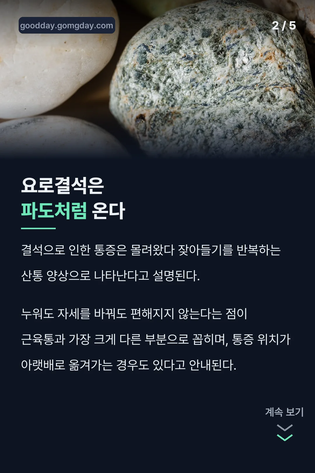 요로결석 통증이 파도처럼 몰려온다는 특징