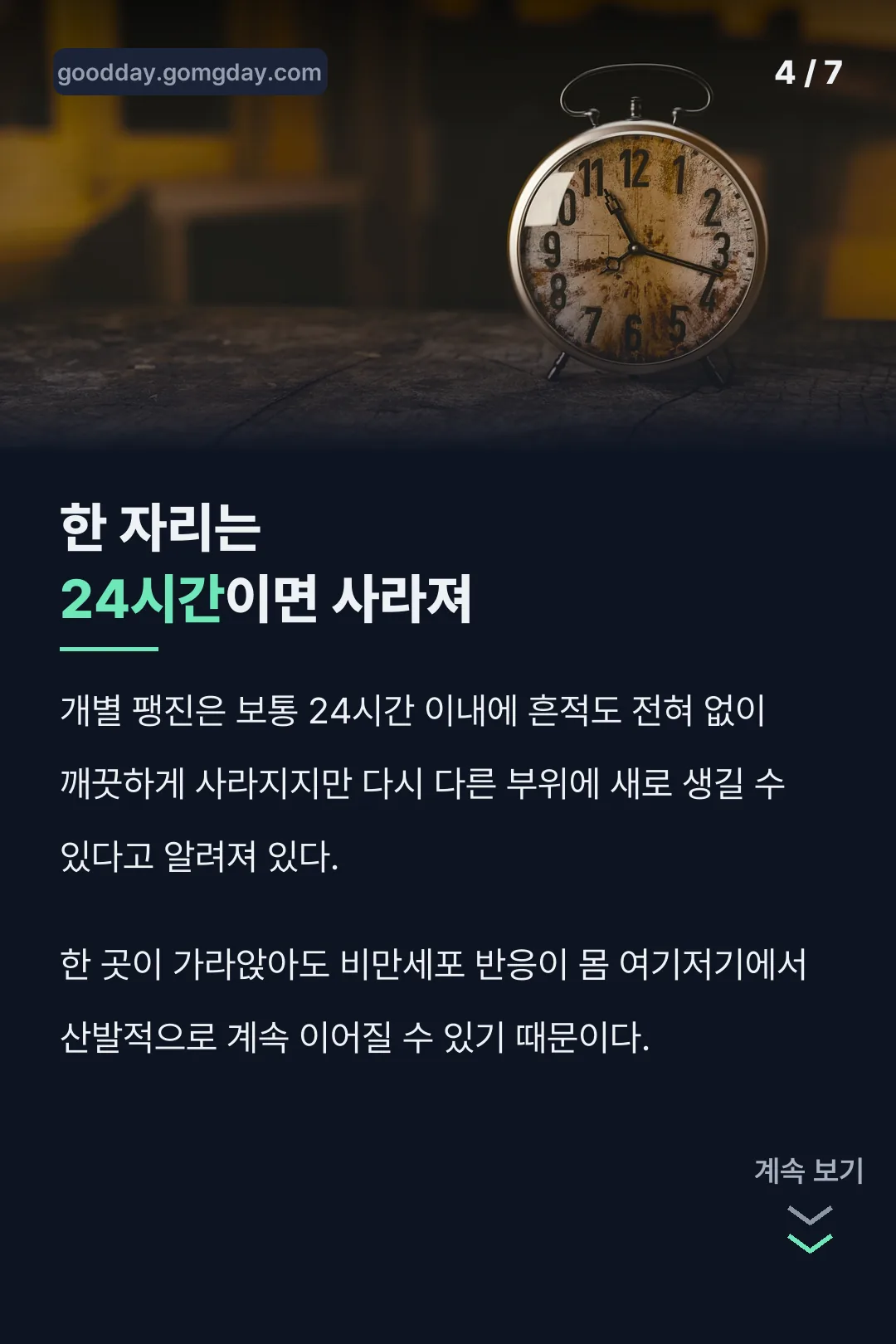 24시간내 사라지는 특징