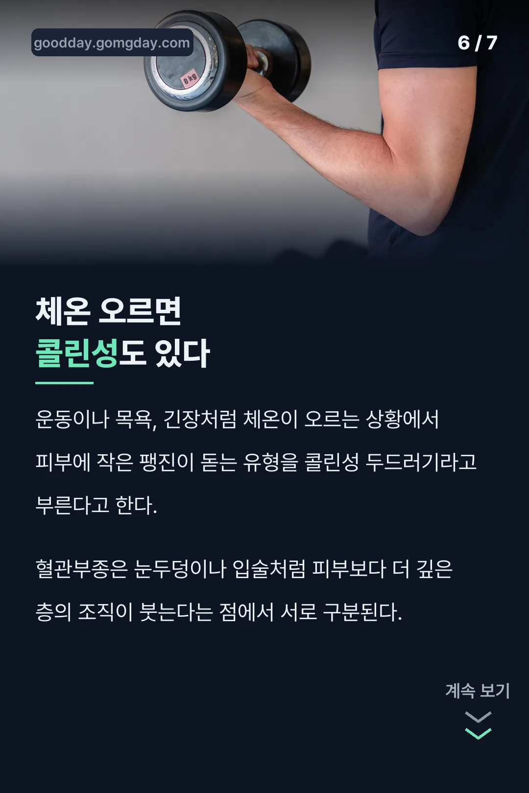 콜린성두드러기 혈관부종 비교