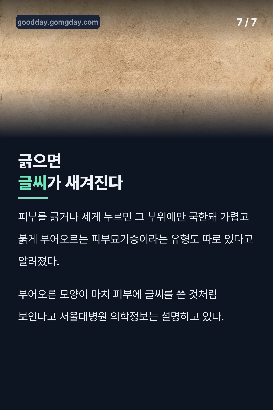 피부묘기증 특이유형 설명